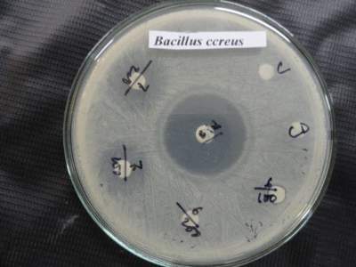 Bacillus ccreus