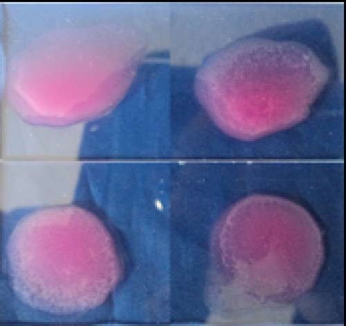Rose Bengal Plate Agglutination test (RBPT): Note the clear clump formation depicting agglutination reaction
