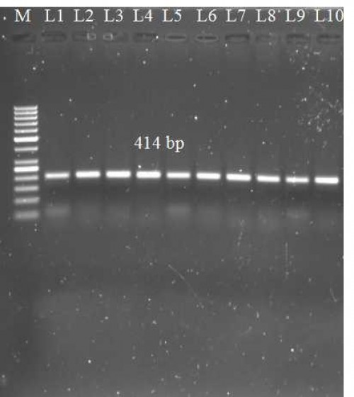 1.5% Agarose gel electrophoresis of PCR products of cathelicidin gene.