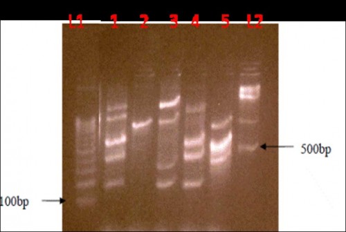 Genomic DNA concentration of five different leaf samples (L1; 2, L2; 3, L3; 4, L4; 5,)