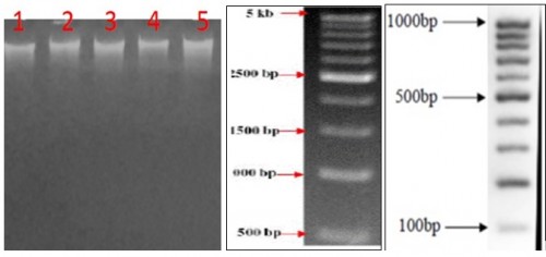 Gel pictures showing RAPD profile of five samples with Primer 1(A), Primer 2 (B) and Primer 3 (c) (L1: 500 bp ladder, 1: sample from L1, 2: Sample from L2, 3: Sample from L3, 4: Sample from L4, 5: Sample from L5)